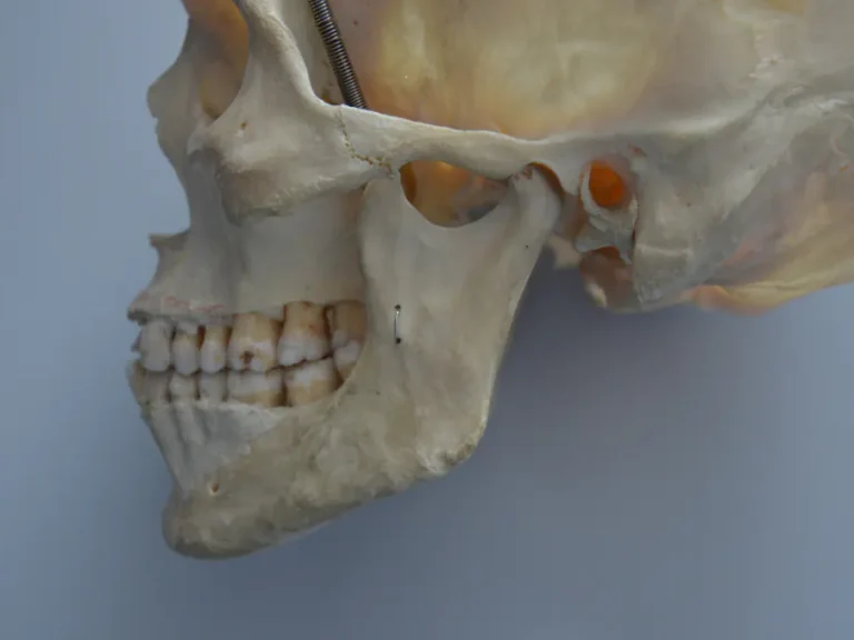 articulation temporo-mandibulaire